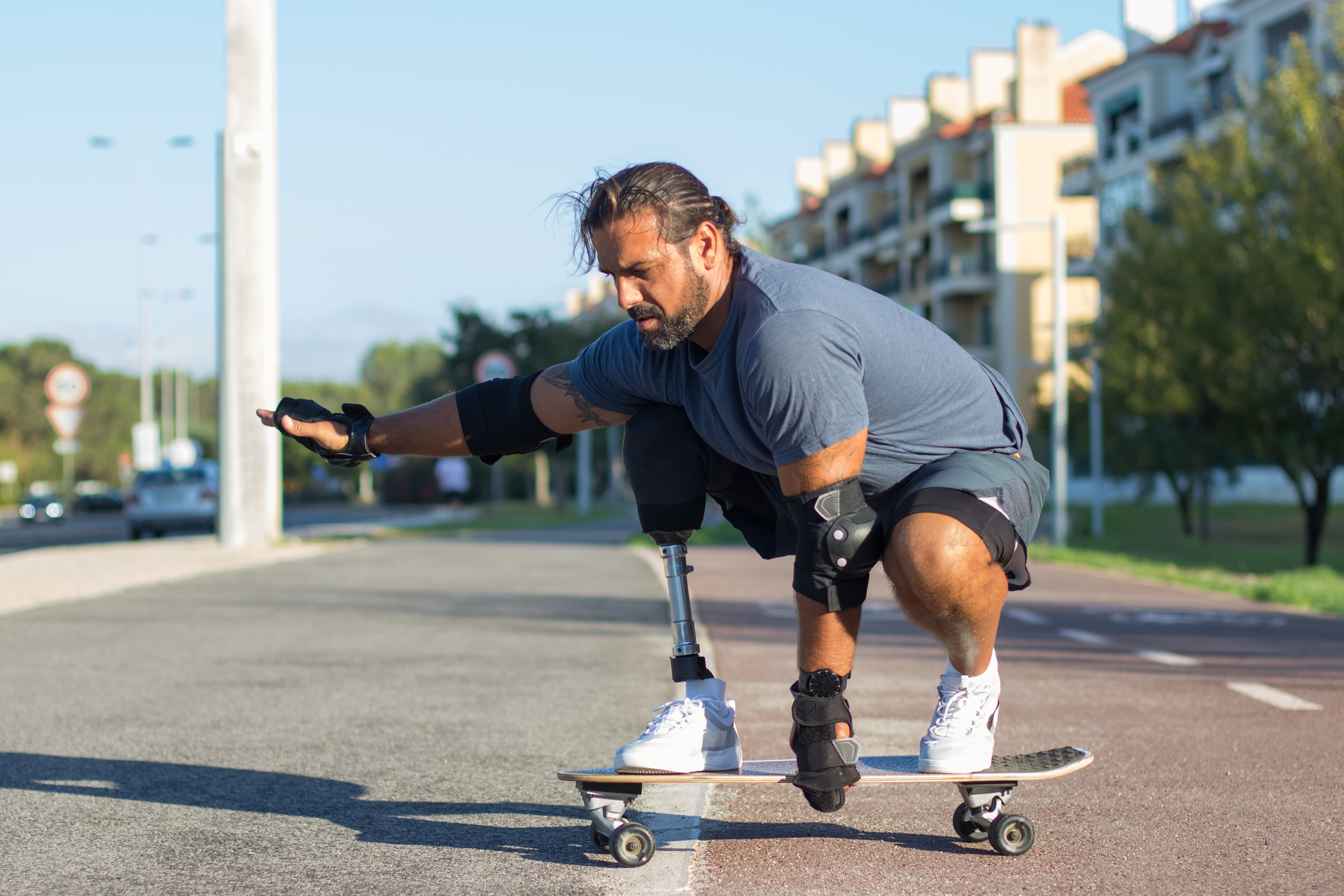 Person living independently with a prosthetic limb
