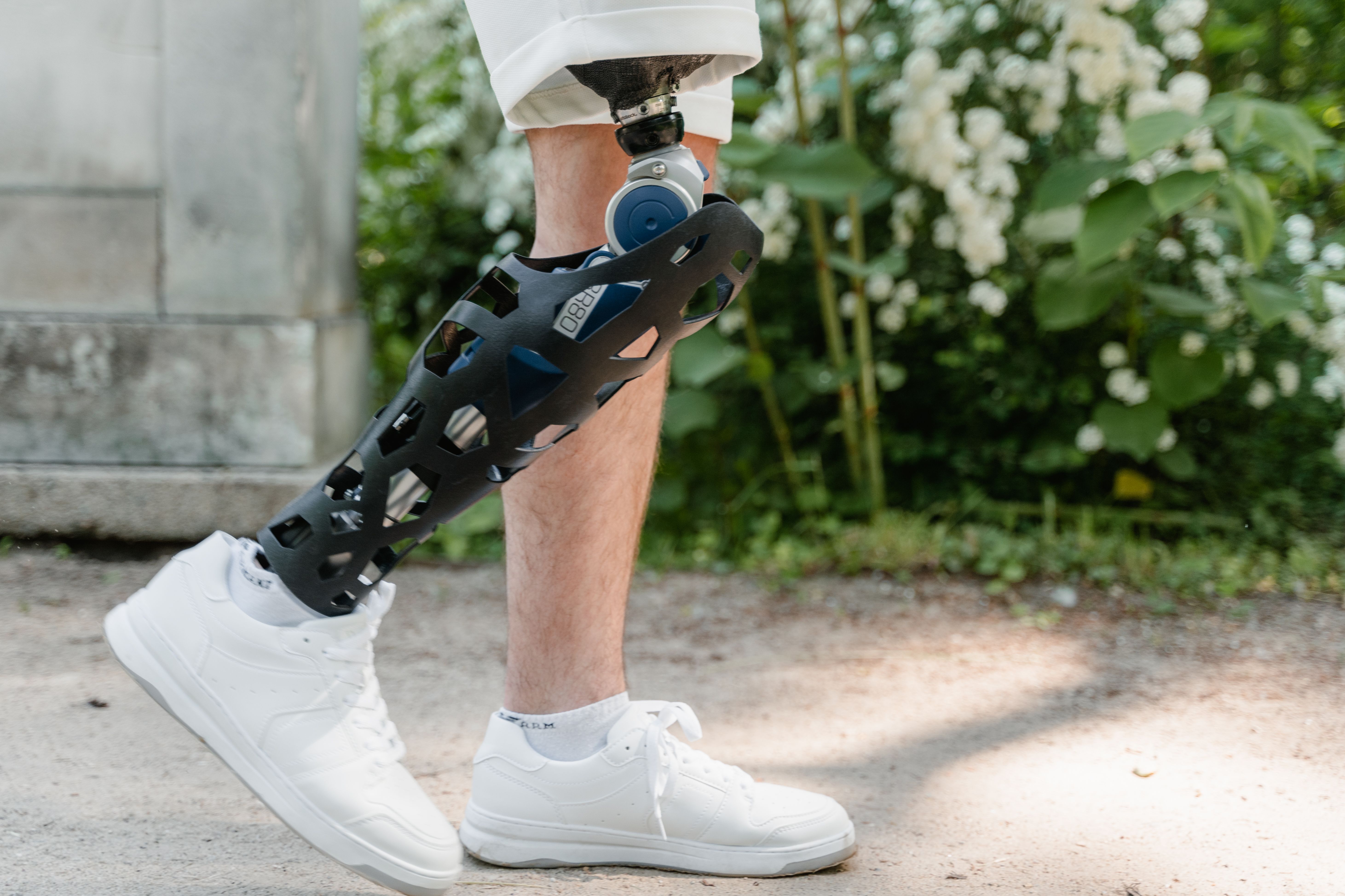 Prosthetic consultation at Relimb